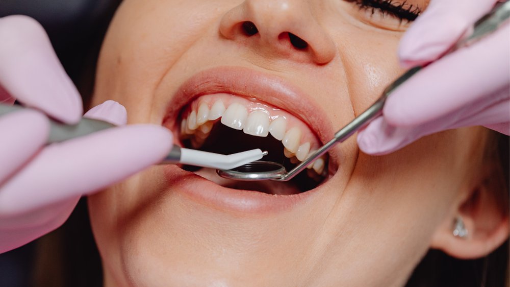 Kanal Tedavisi Ne Zaman Gereklidir?